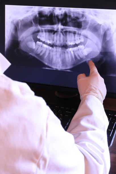 Best Emergency Dental Surgery in Teague, TX