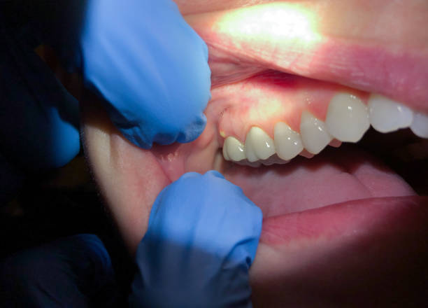 Best Pediatric Emergency Dentist in Teague, TX